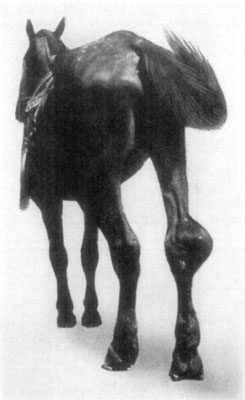 Fig. 59—Another view of same case as illustrated in Fig.
58. Fig. 59—Another view of same case as illustrated in Fig.
58.