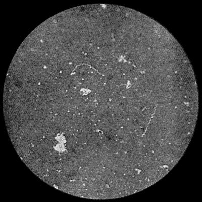 Fig. 36.&mdash;Spiroch&aelig;ta pallida from scraping of hard Chancre of Prepuce. &times; 1000 diam. Burri method.