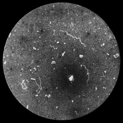 Fig. 37.&mdash;Spiroch&aelig;ta refrigerans from scraping of Vagina. &times; 1000 diam. Burri method.