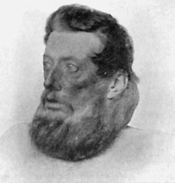 Fig. 47.&mdash;Diffuse Lipomatosis of Neck.