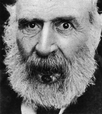 Fig. 58.&mdash;Epithelioma of Lip.