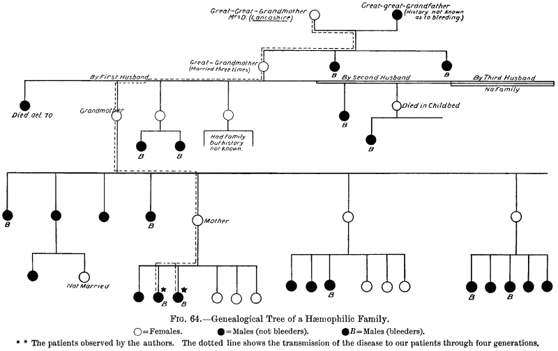 Fig. 64.&mdash;Genealogical Tree if a H&aelig;mophilic Family.