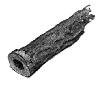 Fig. 122.&mdash;Tubular Sequestrum resulting from Septic Osteomyelitis in Amputation Stump.