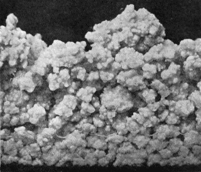 Fig. 169.&mdash;Multiple Cartilaginous Loose Bodies from Knee-joint.