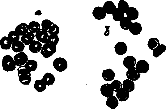 Illustration:
Fig. 38. Red corpuscles of human blood,