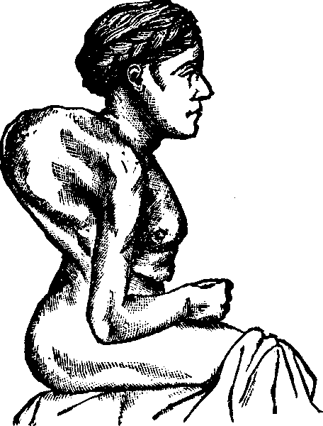 Illustration:
Fig. 3.