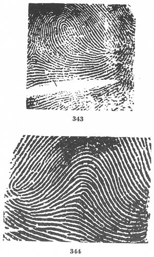 Figs. 343-344 Figs. 343-344