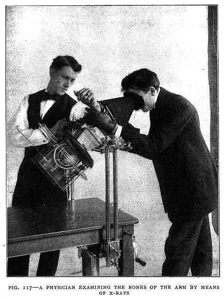 FIG. 117&ndash;A PHYSICIAN EXAMINING THE BONES OF THE ARM BY MEANS OF X-RAYS